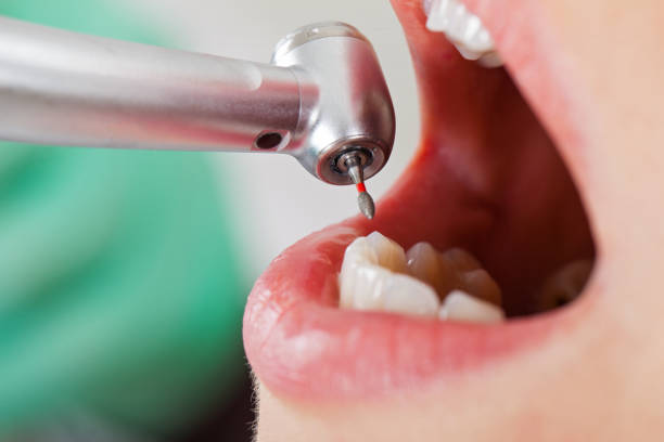 Best Emergency Root Canal Therapy in Smiths Station, AL